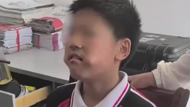 三角尺塞进嘴中被卡
