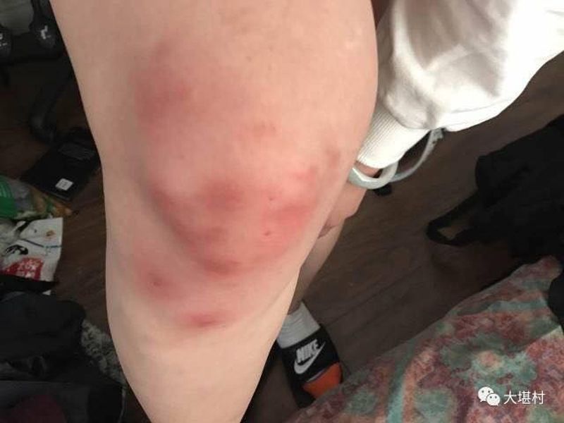 震惊！中国夫妇在澳遭殴打事件细节曝光，背后真相令人愤怒！