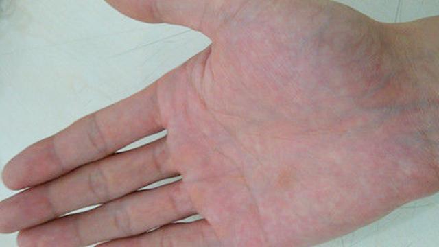 🔍震惊！看手就能知道肝好不好！医生不会告诉你的秘密！