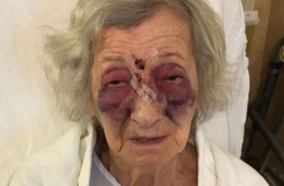 震惊！护女被打成90岁脑龄，父亲泪诉：谁来还我公道？